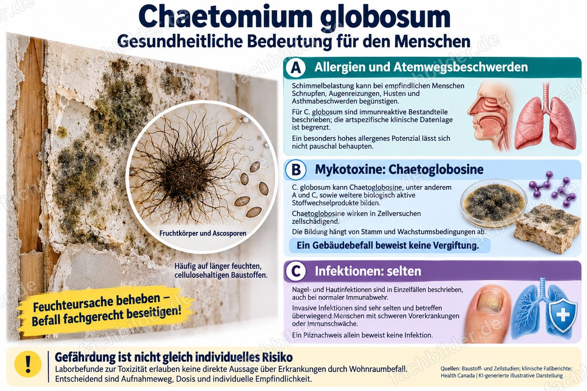 Chaetomium globosum: gesundheitliche Bedeutung